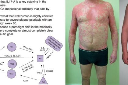 what to know about hizzaboloufazic